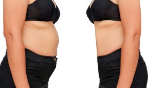 woman-weight-loss-before-after-1